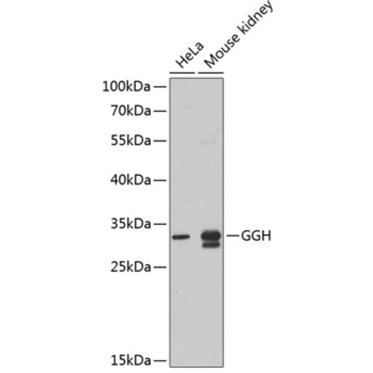 Western Blot - Anti-GGH Antibody (A9709) - Antibodies.com