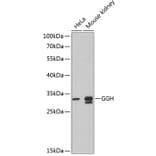 Western Blot - Anti-GGH Antibody (A9709) - Antibodies.com