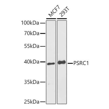 Western Blot - Anti-PSRC1 Antibody (A9710) - Antibodies.com