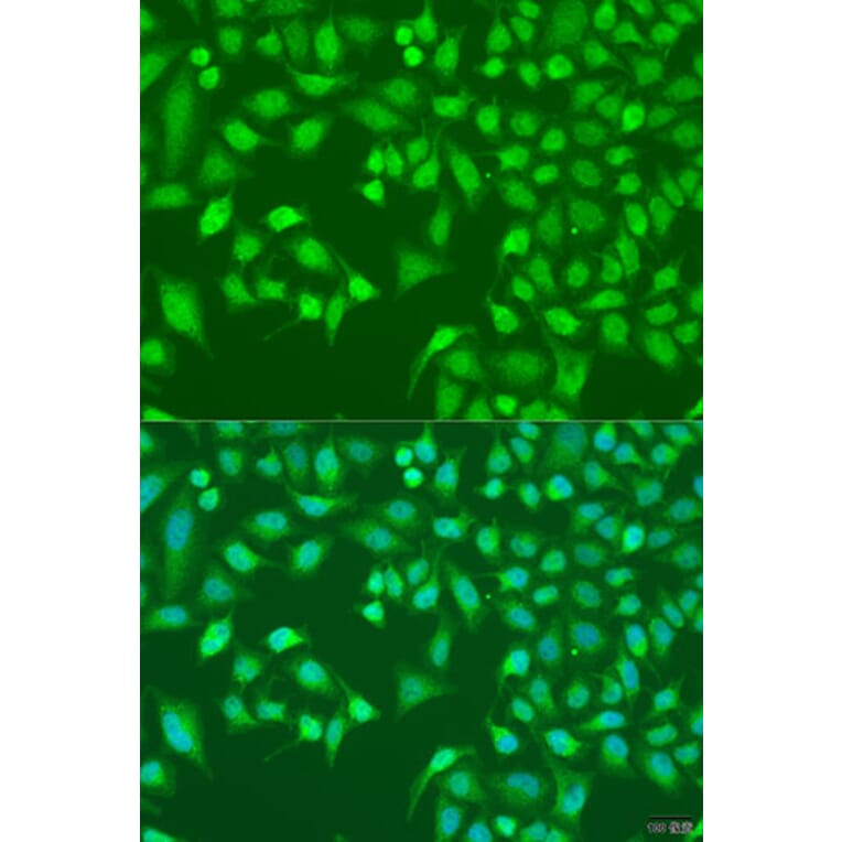 Immunofluorescence - Anti-TRIM22 Antibody (A5508) - Antibodies.com