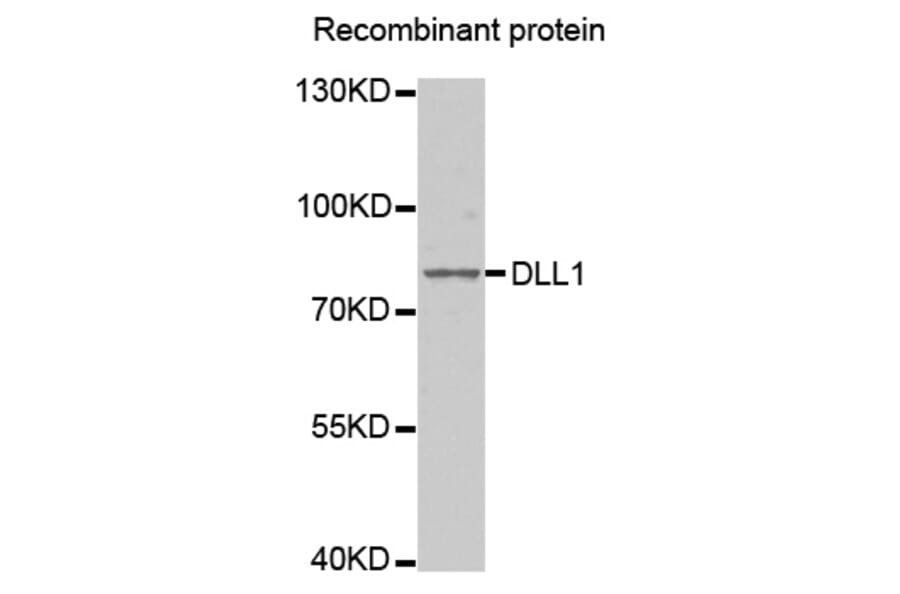 Western Blot - Anti-DLL1 Antibody (A5509) - Antibodies.com