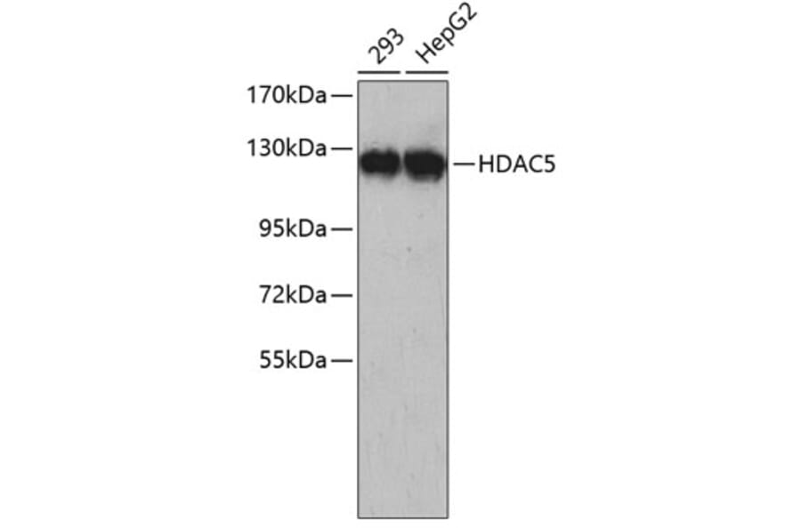 Western Blot - Anti-HDAC5 Antibody (A5519) - Antibodies.com