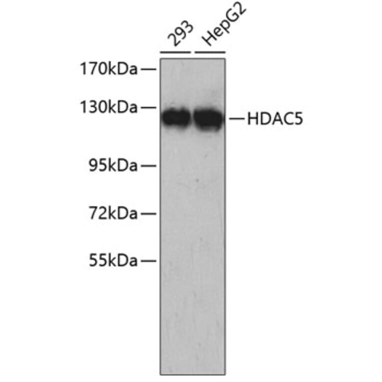 Western Blot - Anti-HDAC5 Antibody (A5519) - Antibodies.com