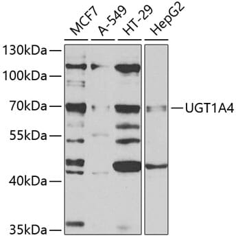Western blot analysis of extracts of various cell lines, using µgT1A4 antibody (A5549) at 1:1,000 dilution.
Secondary antibody: Goat Anti-Rabbit IgG (H+L) (HRP) (AS014) at 1:10,000 dilution.
Lysates / proteins: 25µg per lane.
Blocking buffer: 3% non-fat dry milk in TBST.