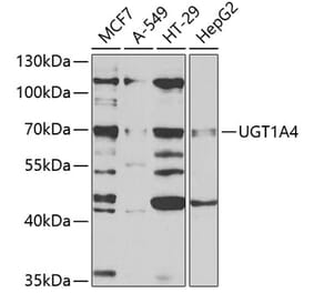 Western Blot - Anti-UGT1A4 Antibody (A9716) - Antibodies.com