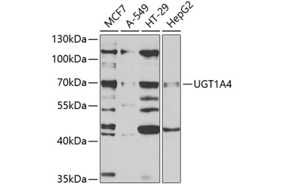 Western Blot - Anti-UGT1A4 Antibody (A9716) - Antibodies.com