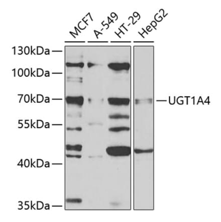 Western Blot - Anti-UGT1A4 Antibody (A9716) - Antibodies.com