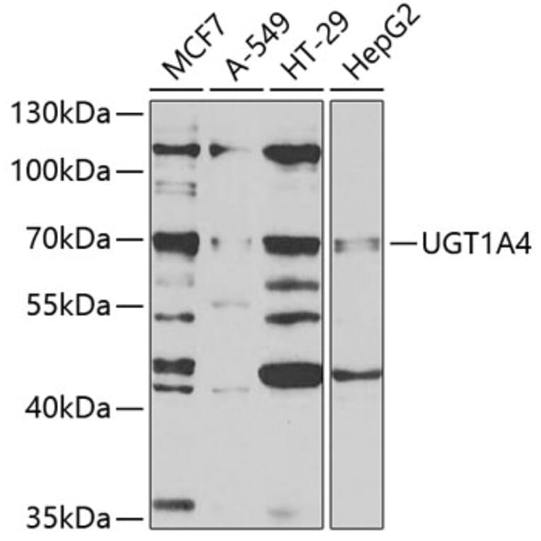 Western Blot - Anti-UGT1A4 Antibody (A9716) - Antibodies.com