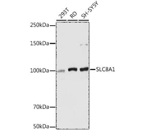 Western Blot - Anti-NCX1 Antibody (A9718) - Antibodies.com