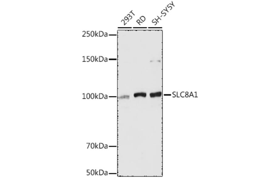 Western Blot - Anti-NCX1 Antibody (A9718) - Antibodies.com