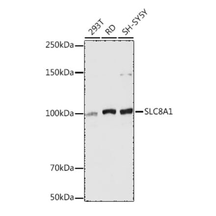 Western Blot - Anti-NCX1 Antibody (A9718) - Antibodies.com