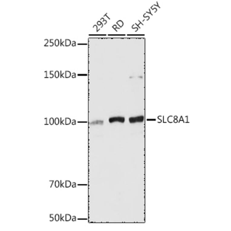 Western Blot - Anti-NCX1 Antibody (A9718) - Antibodies.com