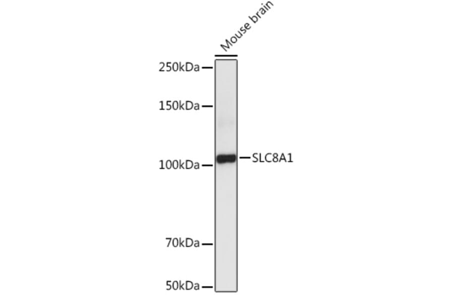 Western Blot - Anti-NCX1 Antibody (A9718) - Antibodies.com