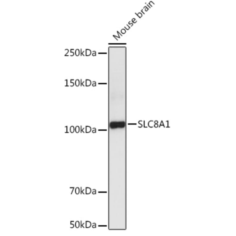 Western Blot - Anti-NCX1 Antibody (A9718) - Antibodies.com