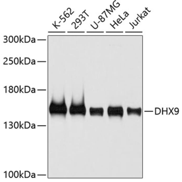 Western Blot - Anti-DHX9 Antibody (A5585) - Antibodies.com