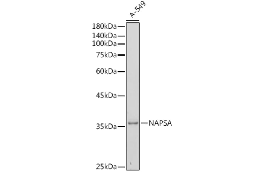 Western Blot - Anti-NAPSIN A Antibody (A9722) - Antibodies.com
