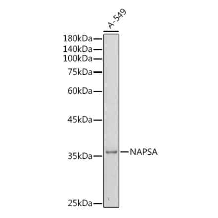 Western Blot - Anti-NAPSIN A Antibody (A9722) - Antibodies.com