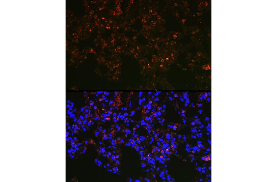 Immunofluorescence - Anti-NAPSIN A Antibody (A9722) - Antibodies.com