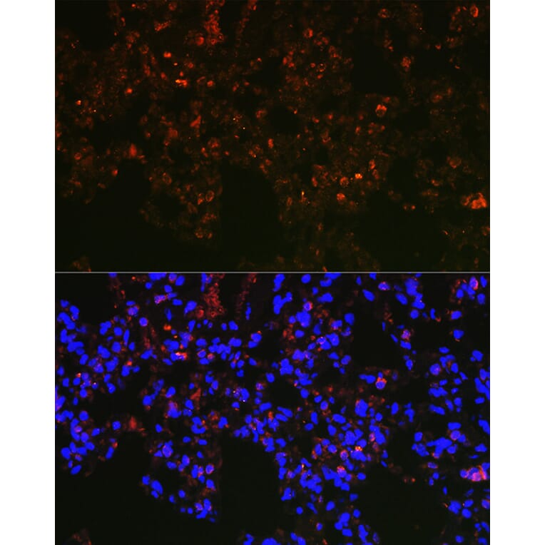 Immunofluorescence - Anti-NAPSIN A Antibody (A9722) - Antibodies.com