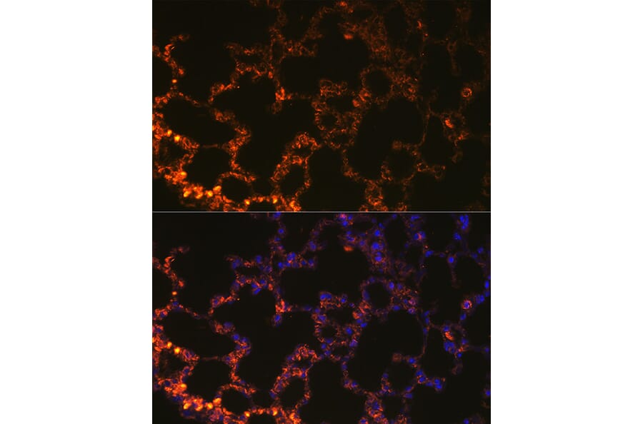 Immunofluorescence - Anti-NAPSIN A Antibody (A9722) - Antibodies.com