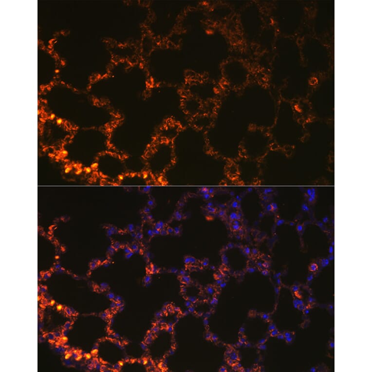 Immunofluorescence - Anti-NAPSIN A Antibody (A9722) - Antibodies.com