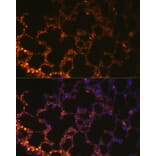 Immunofluorescence - Anti-NAPSIN A Antibody (A9722) - Antibodies.com