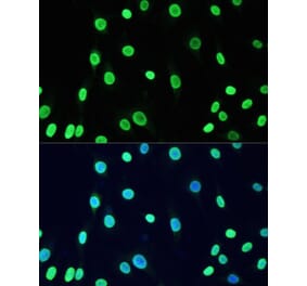 Immunofluorescence - Anti-Dnmt1 (acetyl Lys1127 + Lys1129 + Lys1131 + Lys1133) Antibody (A9723) - Antibodies.com