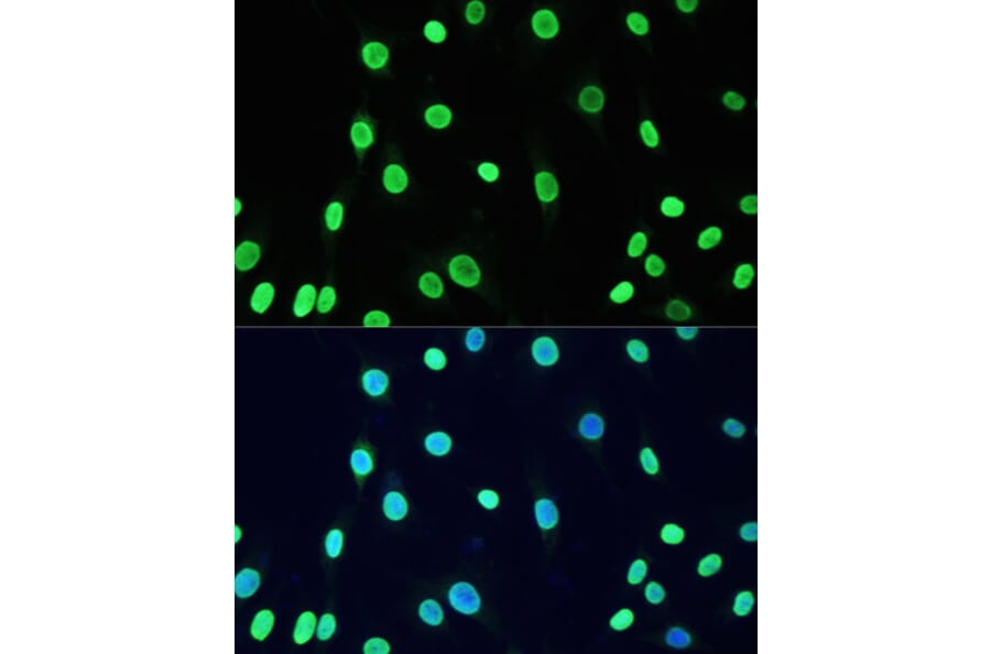 Immunofluorescence - Anti-Dnmt1 (acetyl Lys1127 + Lys1129 + Lys1131 + Lys1133) Antibody (A9723) - Antibodies.com