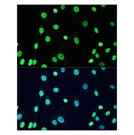 Immunofluorescence - Anti-Dnmt1 (acetyl Lys1127 + Lys1129 + Lys1131 + Lys1133) Antibody (A9723) - Antibodies.com