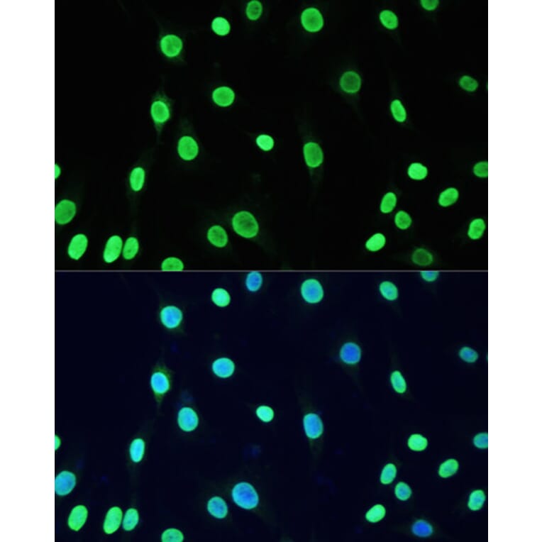 Immunofluorescence - Anti-Dnmt1 (acetyl Lys1127 + Lys1129 + Lys1131 + Lys1133) Antibody (A9723) - Antibodies.com