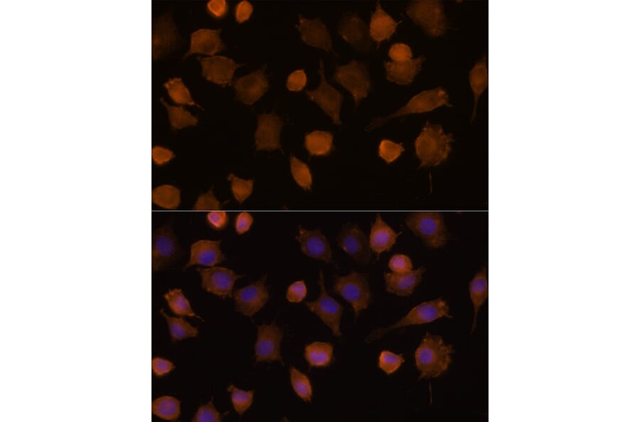 Immunofluorescence - Anti-ICAM1 Antibody (A9725) - Antibodies.com