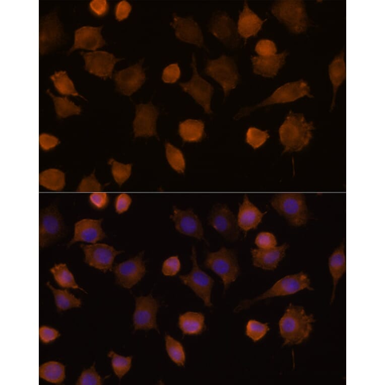 Immunofluorescence - Anti-ICAM1 Antibody (A9725) - Antibodies.com