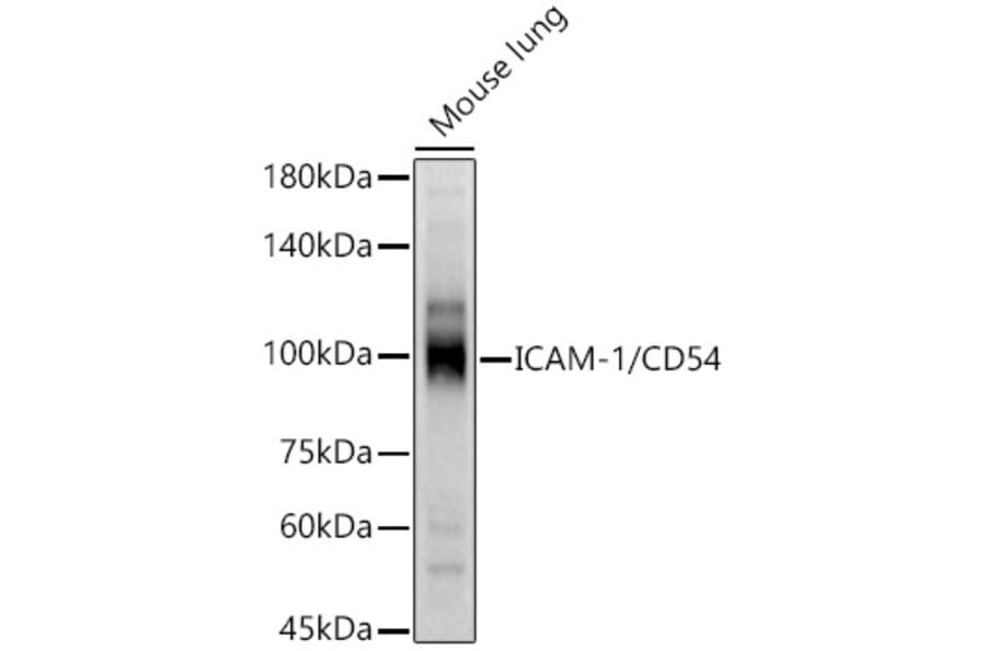 Western Blot - Anti-ICAM1 Antibody (A9725) - Antibodies.com