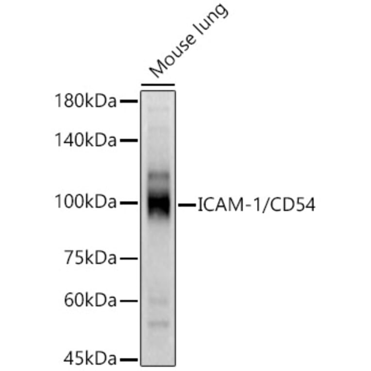 Western Blot - Anti-ICAM1 Antibody (A9725) - Antibodies.com