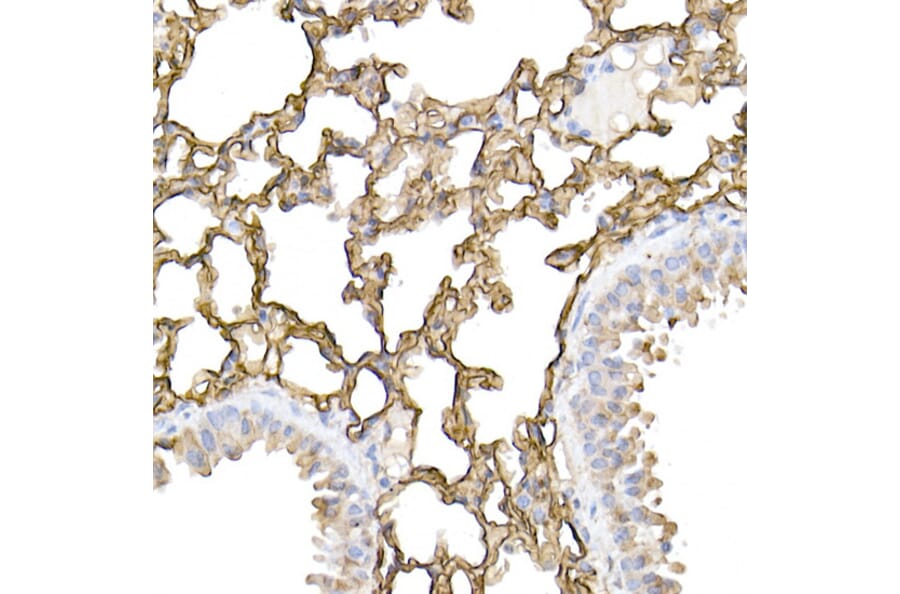 Immunohistochemistry - Anti-ICAM1 Antibody (A9725) - Antibodies.com