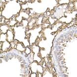 Immunohistochemistry - Anti-ICAM1 Antibody (A9725) - Antibodies.com