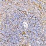 Immunohistochemistry - Anti-ICAM1 Antibody (A9725) - Antibodies.com