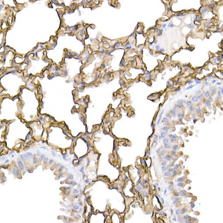 Immunohistochemistry - Anti-ICAM1 Antibody (A9725) - Antibodies.com