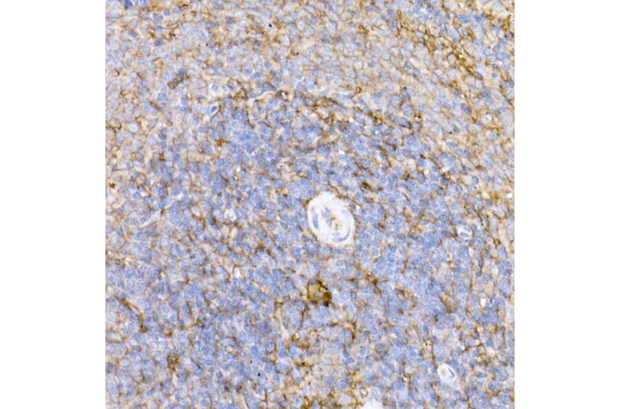 Immunohistochemistry - Anti-ICAM1 Antibody (A9725) - Antibodies.com