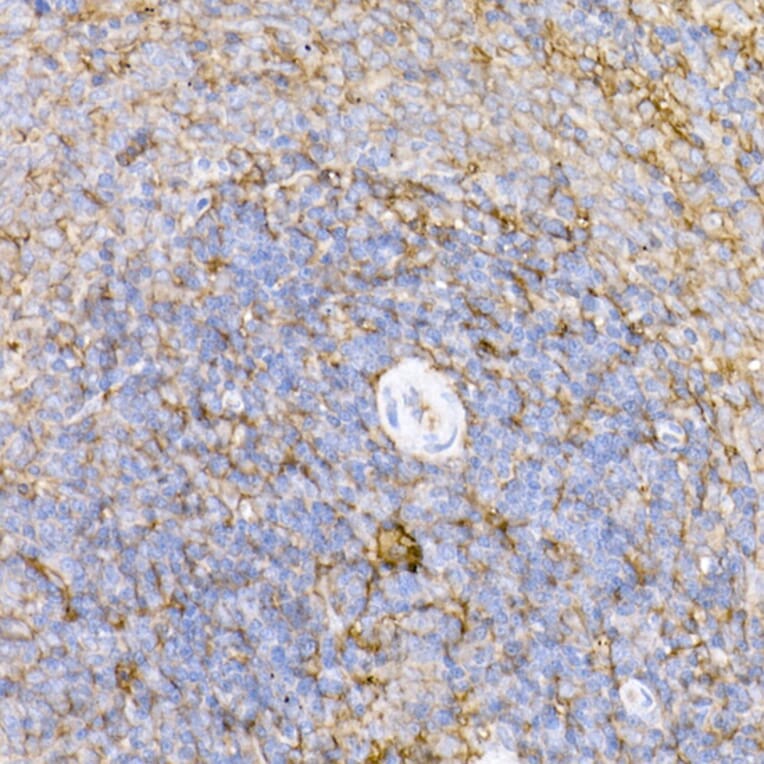 Immunohistochemistry - Anti-ICAM1 Antibody (A9725) - Antibodies.com