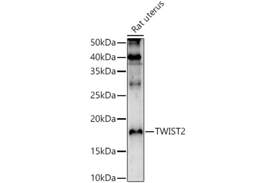 Western Blot - Anti-Twist2 Antibody (A9726) - Antibodies.com