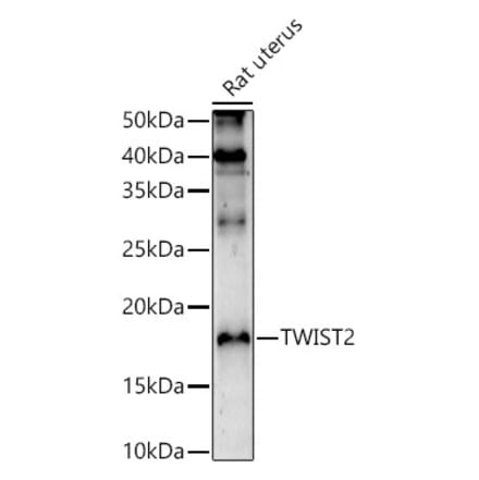 Western Blot - Anti-Twist2 Antibody (A9726) - Antibodies.com