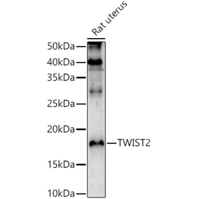 Western Blot - Anti-Twist2 Antibody (A9726) - Antibodies.com