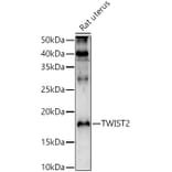 Western Blot - Anti-Twist2 Antibody (A9726) - Antibodies.com
