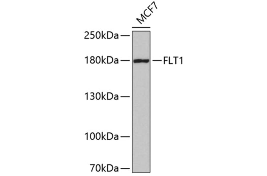 Western Blot - Anti-FLT1 Antibody (A5608) - Antibodies.com