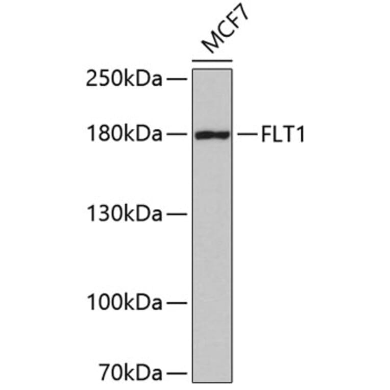 Western Blot - Anti-FLT1 Antibody (A5608) - Antibodies.com