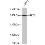 Western Blot - Anti-FLT1 Antibody (A5608) - Antibodies.com