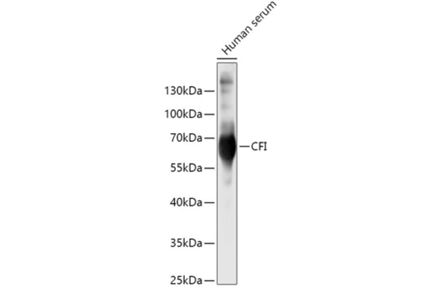 Western Blot - Anti-Factor I/CFI Antibody (A9728) - Antibodies.com