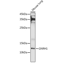 Western Blot - Anti-GnRH Antibody (A9729) - Antibodies.com