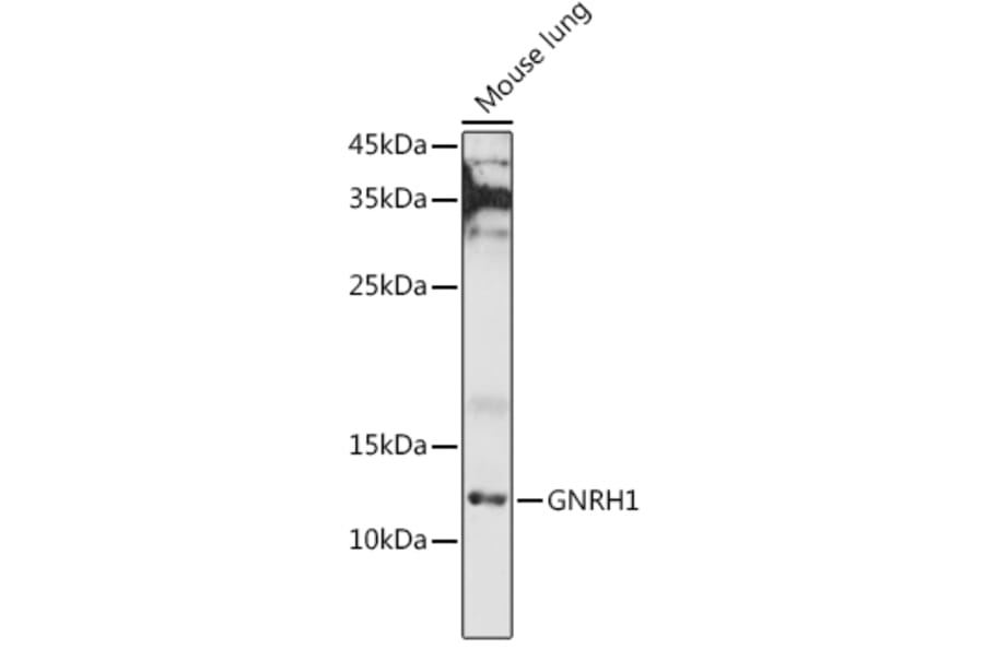 Western Blot - Anti-GnRH Antibody (A9729) - Antibodies.com